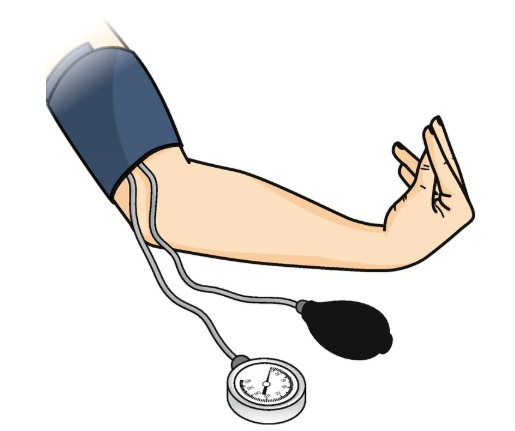 CPG Hypocalcaemia positive trousseau sign CPG Hypocalcaemia positive trousseau sign